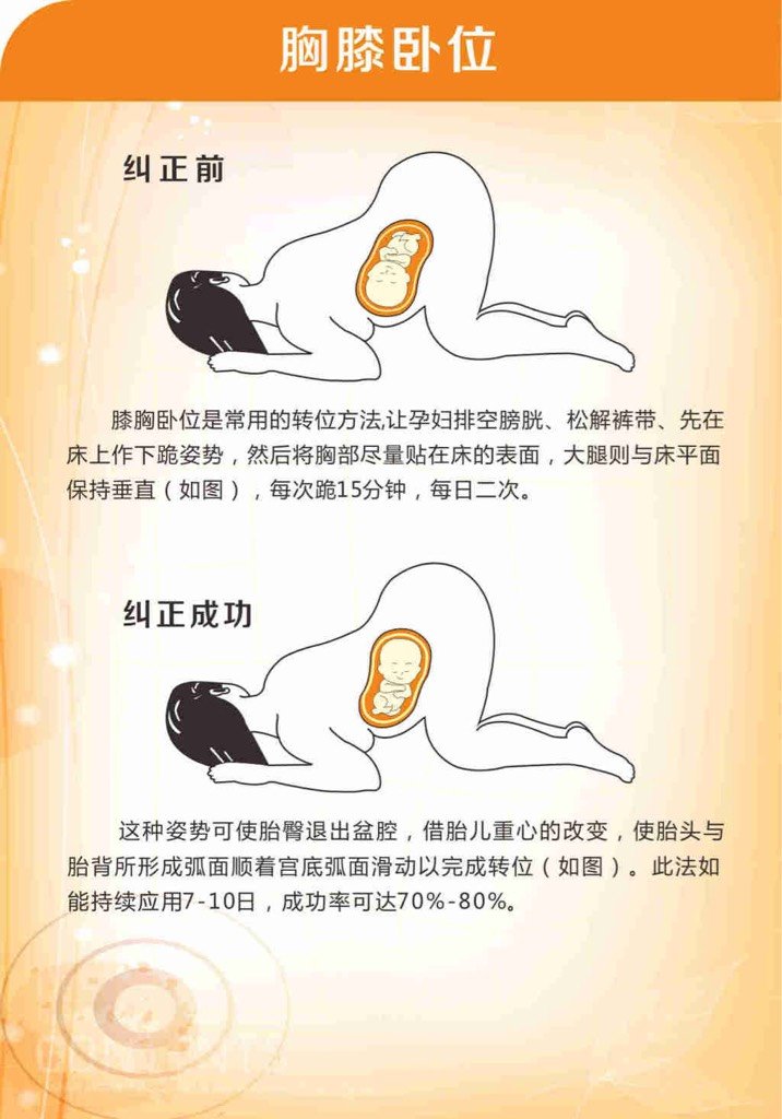 四个月胎位不正怎么办