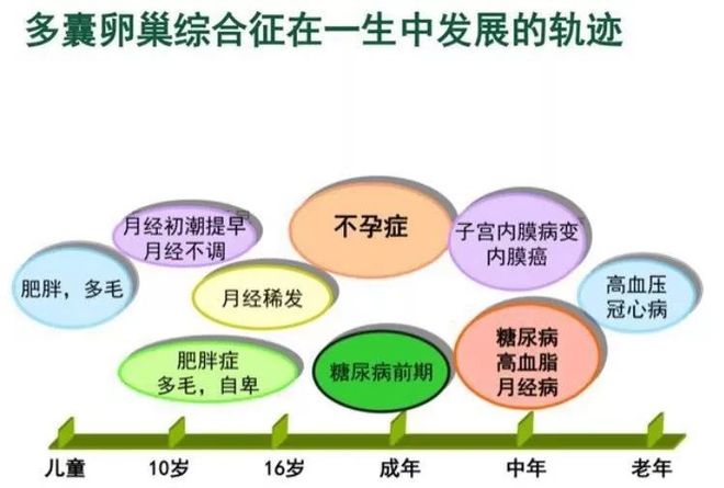 多囊卵巢几个月来月经，解析病症与月经周期的关系